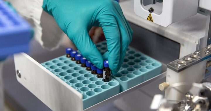 ¡EN LA “POTENCIA” PETROLERA, UN EXAMEN DE SANGRE ES CASI UN LUJO IMPORTADO! CRISIS SILENCIOSA: LABORATORIOS PÚBLICOS EN VENEZUELA OPERAN CON 80% DE DÉFICIT DE INSUMOS